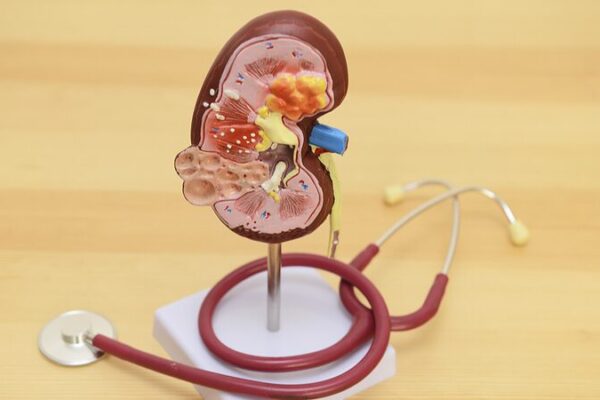 Croatia Makes Medical History with Successful Kidney Autotransplant 🚀 Croatia successfully performs renal autotransplant operation