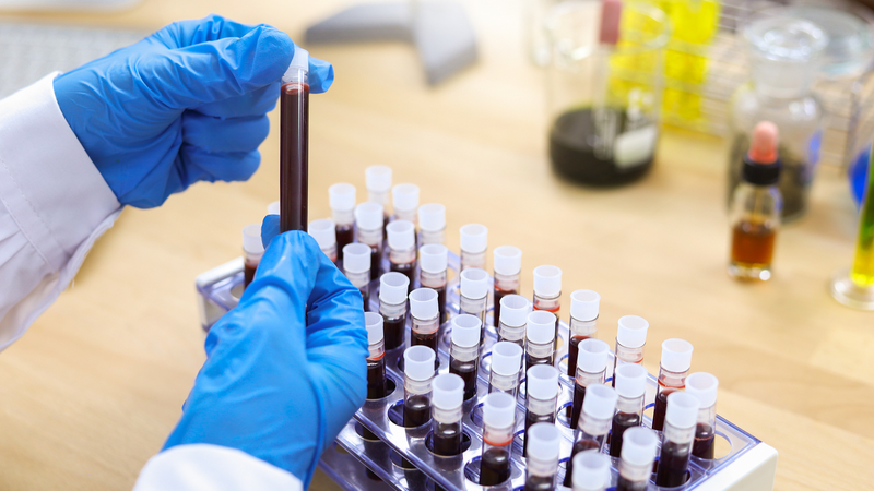 Breakthrough Gene Therapy Revolutionizes Hemophilia Care! Breakthrough_Gene_Therapy_Revolutionizes_Hemophilia_Care_