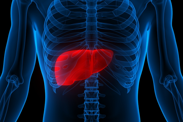 New Hope in Cancer Fight: Silybin Disrupts Tumor Fuel Pathway New_Hope_in_Cancer_Fight__Silybin_Disrupts_Tumor_Fuel_Pathway