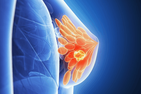 New Insights into Cancer Dormancy Spark Hope for Treatments New_Insights_into_Cancer_Dormancy_Spark_Hope_for_Treatments