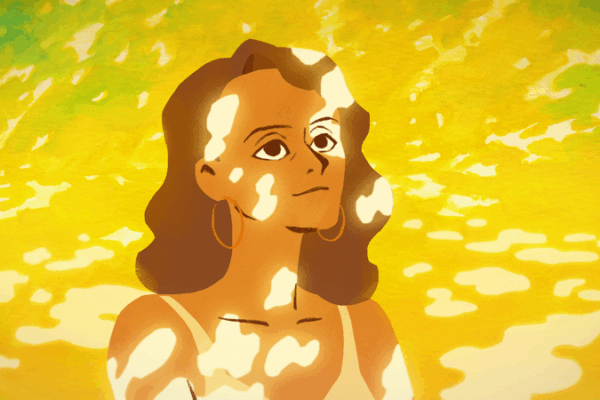 Colorful Courage: Li Jiahao’s Journey with Vitiligo & Animation Colorful_Courage__Li_Jiahao_s_Journey_with_Vitiligo___Animation