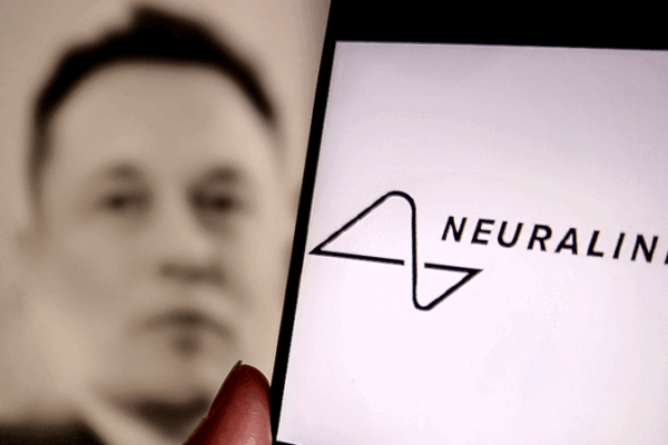 Neuralink’s N1 Implant: Thought Control for Life-Changing Tech! Neuralink_s_N1_Implant__Thought_Control_for_Life_Changing_Tech_