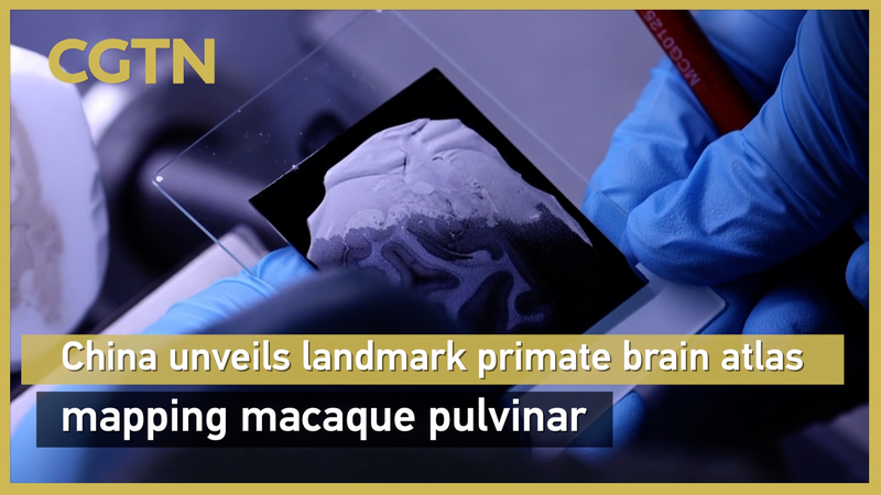 Revolutionary_Primate_Brain_Atlas_Unveiled video poster