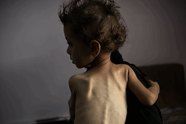 Inside Gaza’s Famine: A Humanitarian Crisis Unpacked Inside_Gaza_s_Famine__A_Humanitarian_Crisis_Unpacked