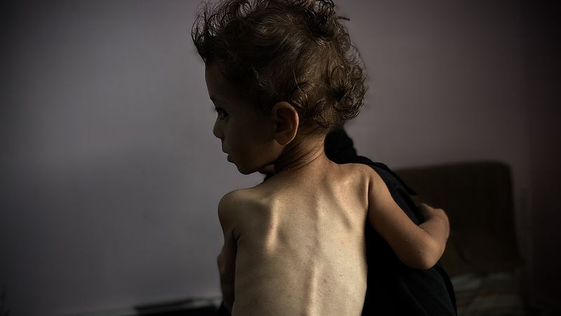 Inside_Gaza_s_Famine__A_Humanitarian_Crisis_Unpacked