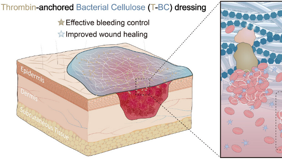 New Bioactive Dressing Halts Bleeding in Under 60 Seconds! New_Bioactive_Dressing_Halts_Bleeding_in_Under_60_Seconds_