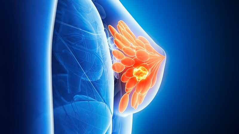 How Breastfeeding Boosts Your Defenses Against Breast Cancer How_Breastfeeding_Boosts_Your_Defenses_Against_Breast_Cancer