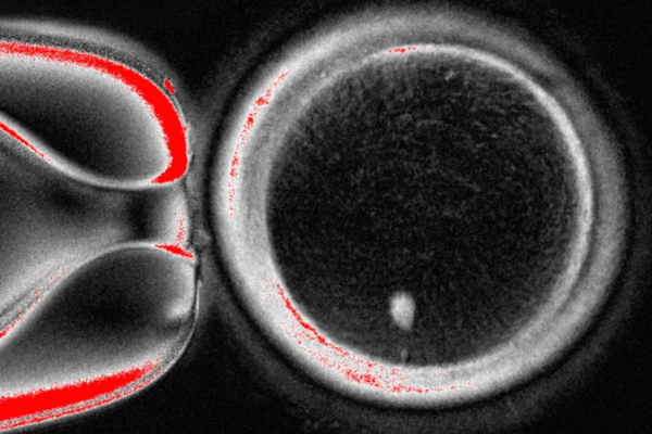 Lab Breakthrough: Turning Skin Cells into Functional Human Eggs Lab_Breakthrough__Turning_Skin_Cells_into_Functional_Human_Eggs
