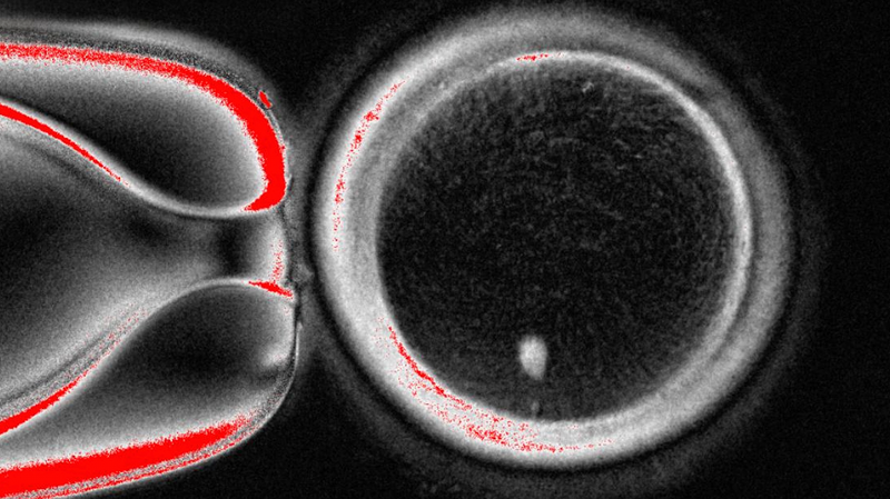 Lab_Breakthrough__Turning_Skin_Cells_into_Functional_Human_Eggs - Namaste Headlines Lab_Breakthrough__Turning_Skin_Cells_into_Functional_Human_Eggs