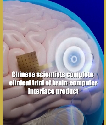 Chinese_Scientists_Complete_Trial_of_World_s_First_Wireless_Brain_Computer_Implant video poster
