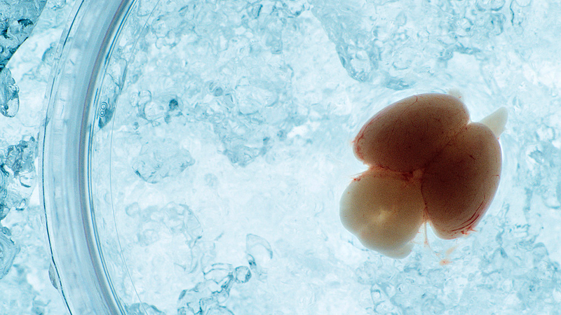 Live_Imaging_Unveils_Embryonic_Mouse_Brain_Development